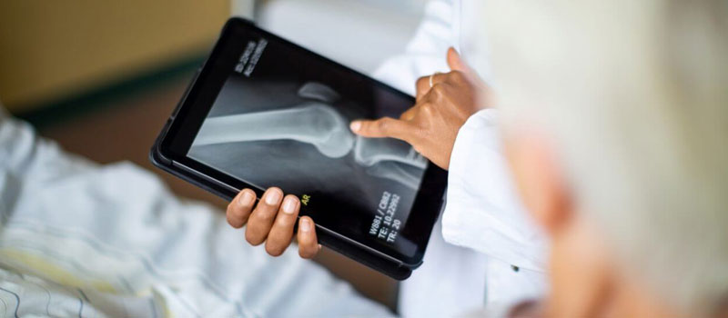 Abdomen X-Ray at Home in Mumbai Abdomen X-Ray at Home in Mumbai