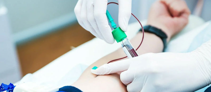 Blood Test at Home in Mumbai Blood Test at Home in Mumbai