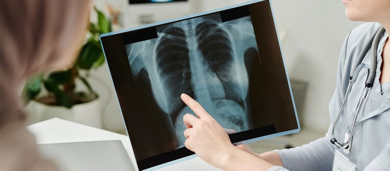 Chest X-Ray Home Service in Mumbai Chest X-Ray Home Service in Mumbai
