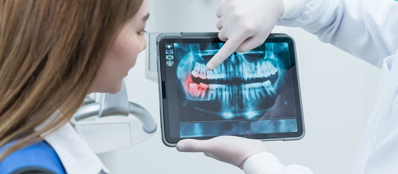 Dental X-Ray at Home in Mumbai Dental X-Ray at Home in Mumbai