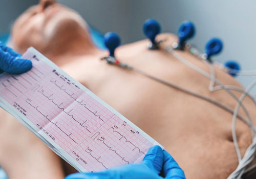 ECG At Home in Mumbai