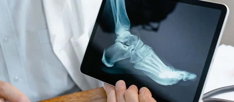 Foot and Ankle X-Ray at Home in Mumbai Foot and Ankle X-Ray at Home in Mumbai