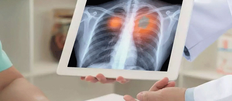 Hassle-Free Senior X-Ray Home Service in Mumbai Hassle-Free Senior X-Ray Home Service in Mumbai
