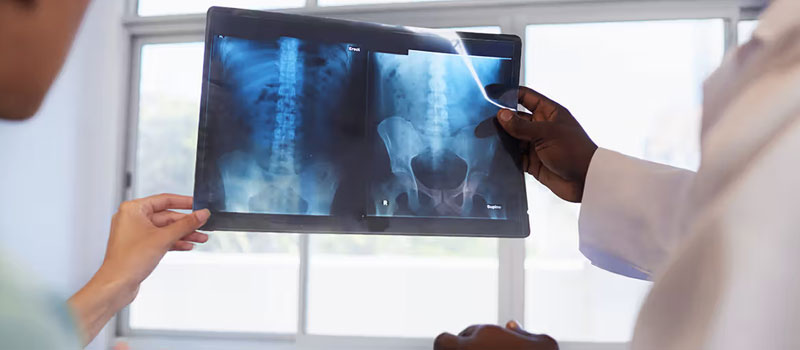 Hip Body X-Ray at Home in Mumbai Hip Body X-Ray at Home in Mumbai