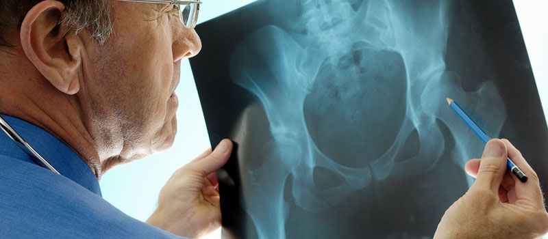 Orthopedic X-Ray at Home in Mumbai Orthopedic X-Ray at Home in Mumbai