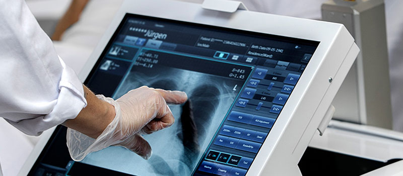Portable X-Ray Service in Tilak Nagar Portable X-Ray Service at Home in Tilak Nagar