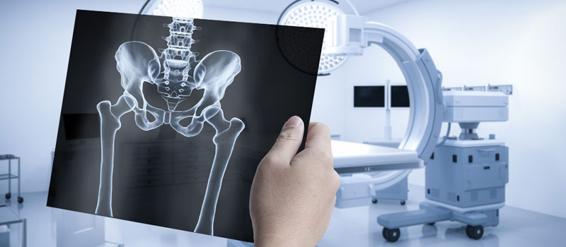 Rapid X-Ray at Home in Mumbai Rapid X-Ray at Home in Mumbai