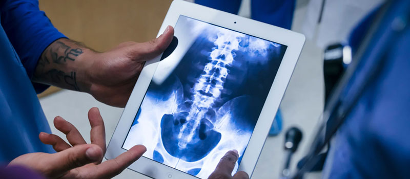 Spine X-Ray at Home in Mumbai Spine X-Ray at Home in Mumbai