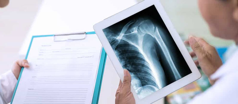 Reliable Trauma X-Ray at Home in Mumbai Reliable Trauma X-Ray at Home in Mumbai