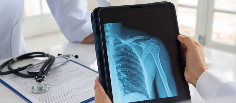 X-Ray at Home in Mumbai X-Ray at Home in Mumbai