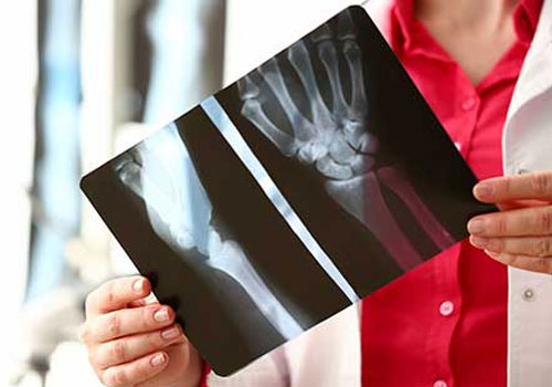 X-Ray at Home in Mumba
